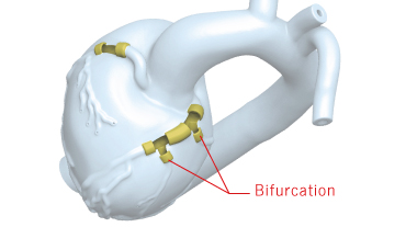 Heart Model for BIF