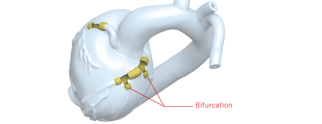 Heart Model for PCI