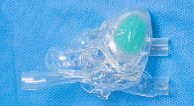 Model for Leadless Pacemaker
