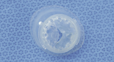 Bicuspid Aortic Valve