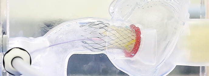 TAVI Model