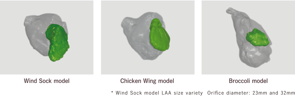 WindStock_ChickenWing_Broccoli-model