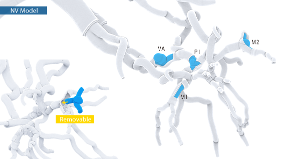 Lesion parts for a variety of procedures