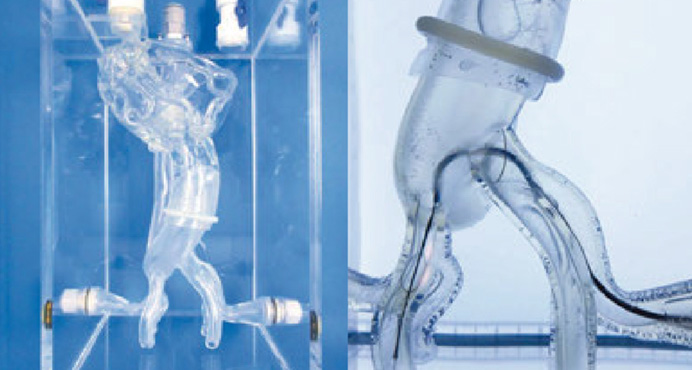 TAVI Cardiocranial Model