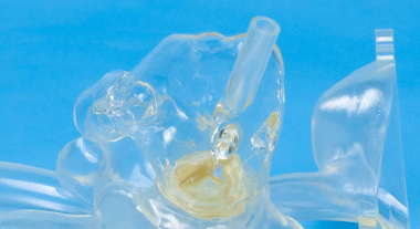 Aortic Regurgitation Model