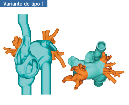 Design de 2 câmaras
