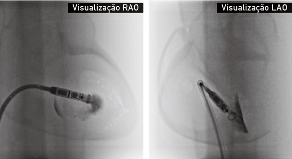 The X-ray image