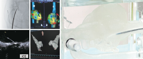 HEARTROID ablation simulation